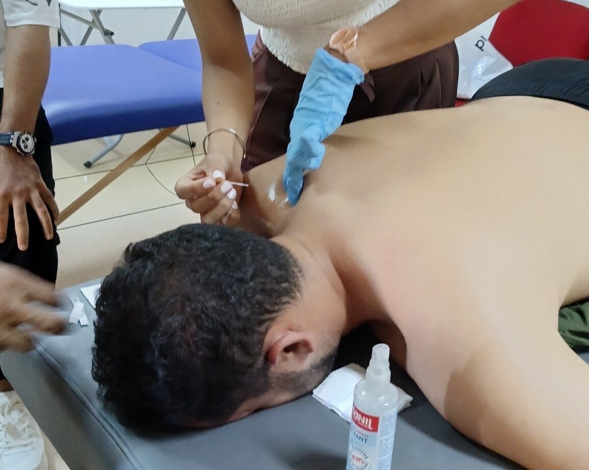 Dry Needling1